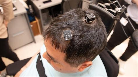 First-of-its-kind AI brain implant surgery helped a man regain feeling ...