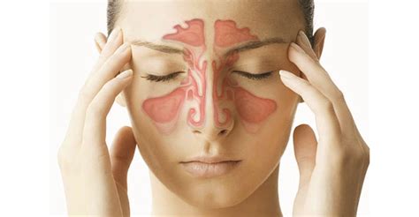 Nasal Congestion - Causes, Symptoms and Treatment