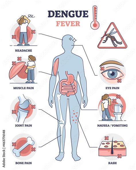 Dengue fever symptoms awareness poster, educational vector illustration ...