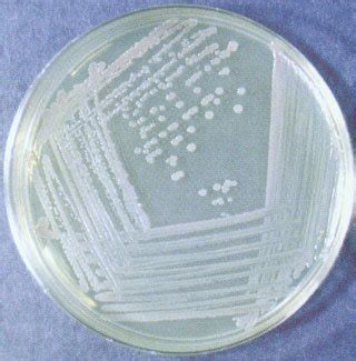 Nutrient Agar: composition, preparation and uses - microbeonline