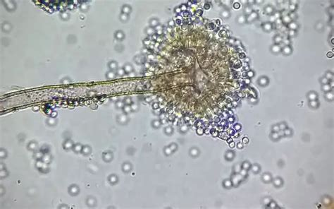 Aspergillus Niger Under Microscope