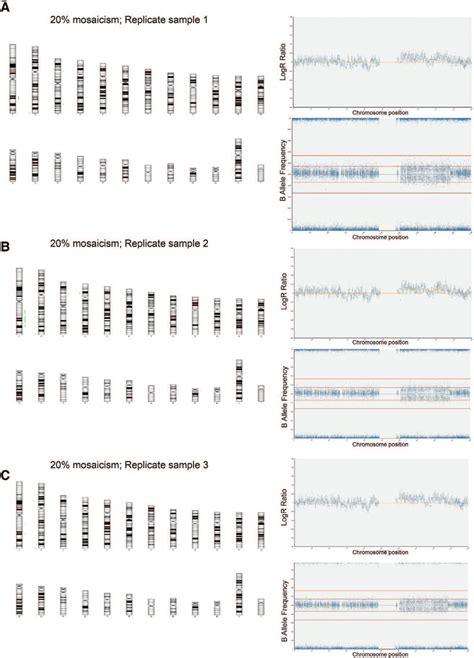 SNP array analysis of samples containing 20% variant cells harboring a ...