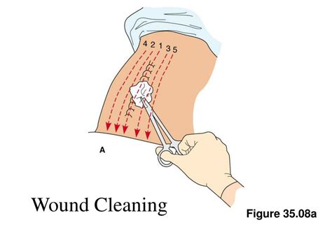 PPT - Wound Care Binders & Bandages Use of Heat and Cold Module 8, Part ...