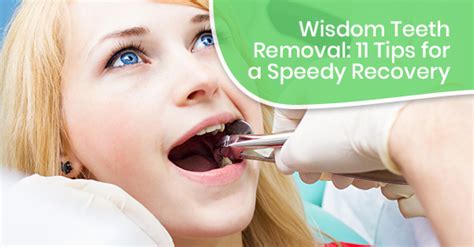 Wisdom Teeth Removal: 11 Tips for a Speedy Recovery