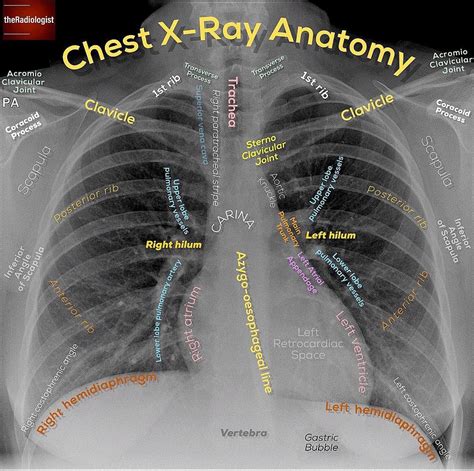 Image may contain: text | Medical anatomy, Radiology, Medical knowledge