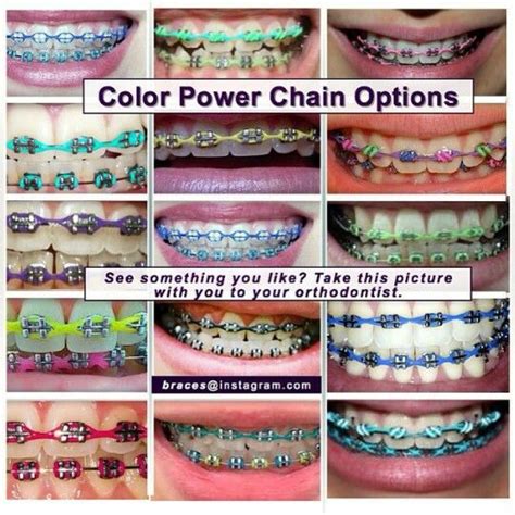 Is Pink A Good Braces Color – Warehouse of Ideas