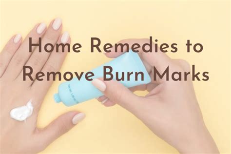 How to Remove Burn Marks? Here are 9 Best Home Remedies to Try