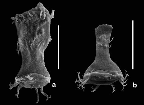 What 415 million year old fossil plankton tells us about heavy metal ...