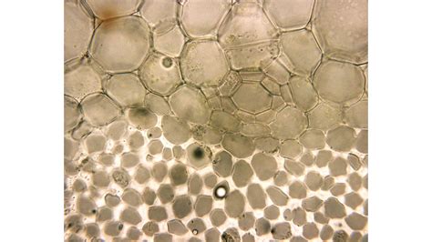 Celery Cross Section: Epidermal Cells, Collenchyma, Parenchyma ...