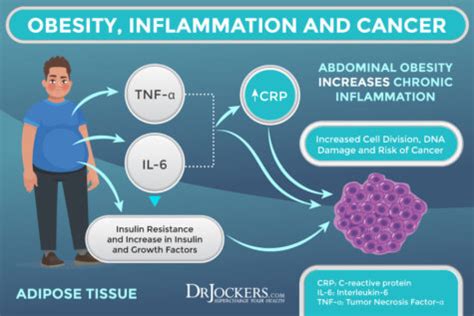 Visceral Fat: What is It and How it Drives Up Inflammation