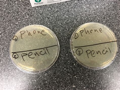 BIOL213 | PLANTS ONE: Mystery TSA Plates