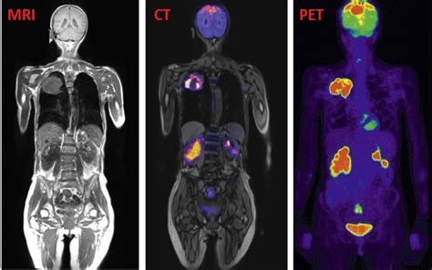 All You Need to Know about MRI and PET/CT Scan