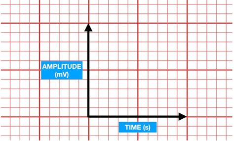 ECG 101: The ECG Paper Explained — The PR Segment.com