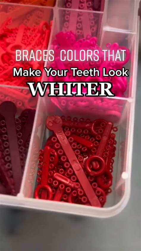 BEST BRACES COLORS! 🪞🤍 in 2024