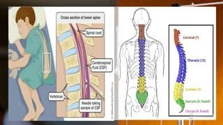 Intrathecal route for chemotherapy | PPT