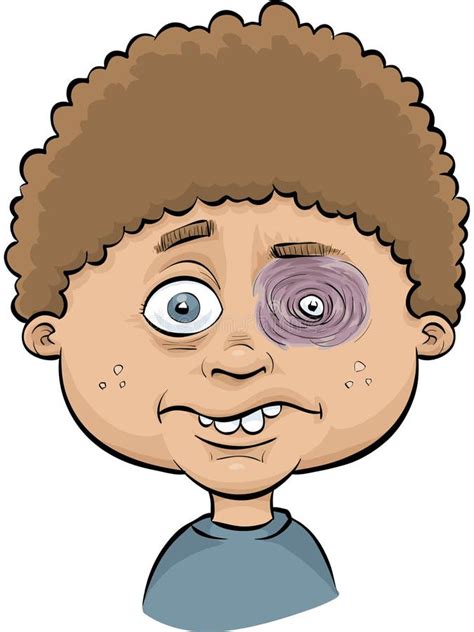 Boy with Black Eye stock illustration. Illustration of cartoon - 41194928