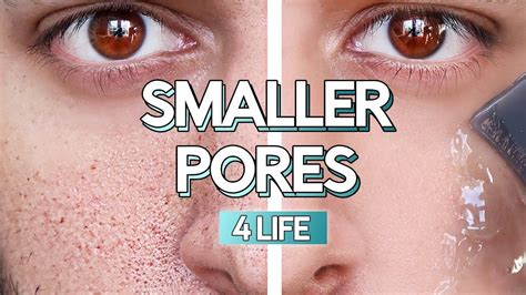 Prevent Enlarged Pores Forever With These Simple Steps - Men's Oily ...