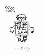 Ray Coloring Drawing Kids Xray Pages Picture Kindergarten Clipart Easy Getdrawings Popular Library Coloringhome sketch template