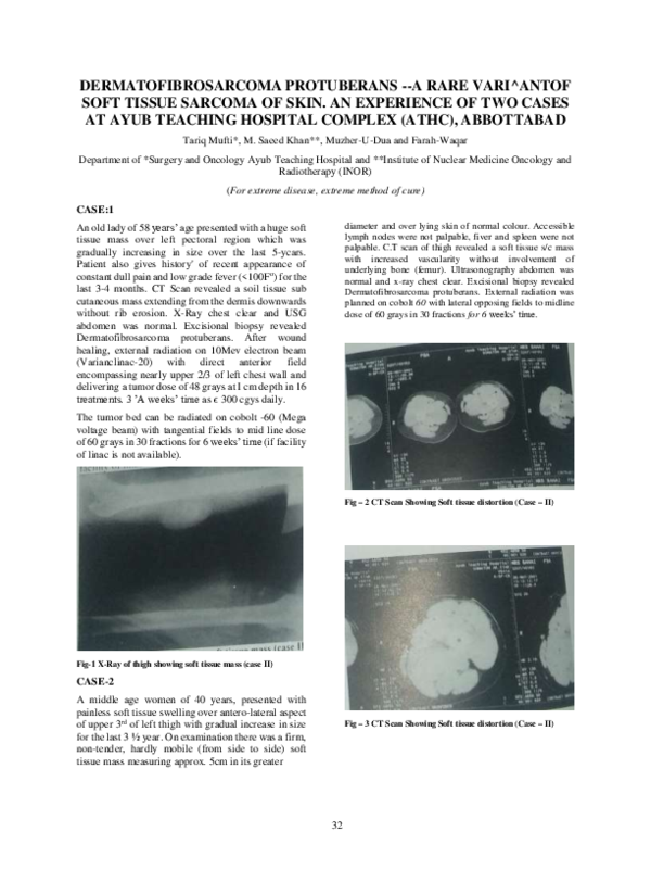 First page of “Dermatofibrosarcoma protuberans--a rare variant of soft tissue sarcoma of skin. An experience of two cases at Ayub Teaching Hospital Complex (ATHC), Abbottabad”