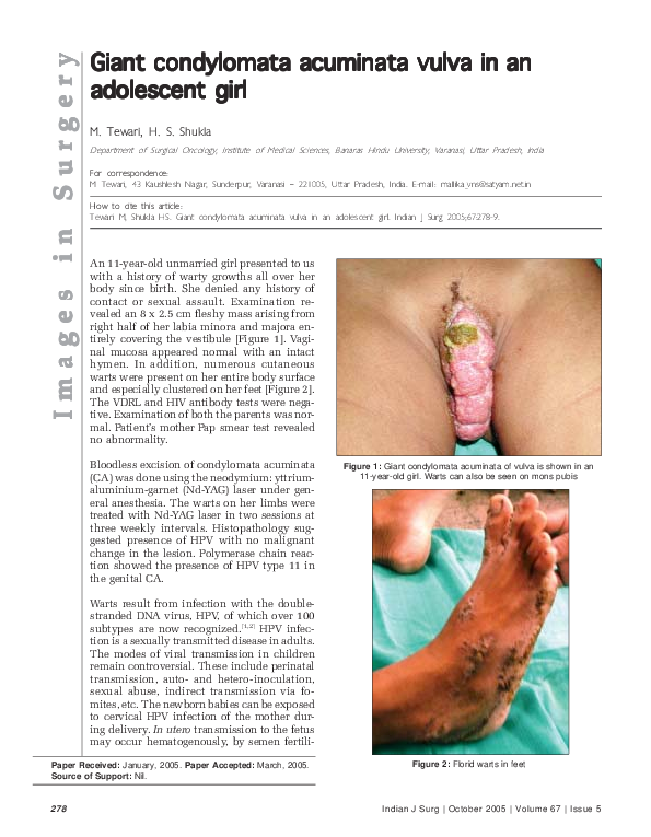 First page of “Images in Surgery - Giant condylomata acuminata vulva in an adolescentgirl”