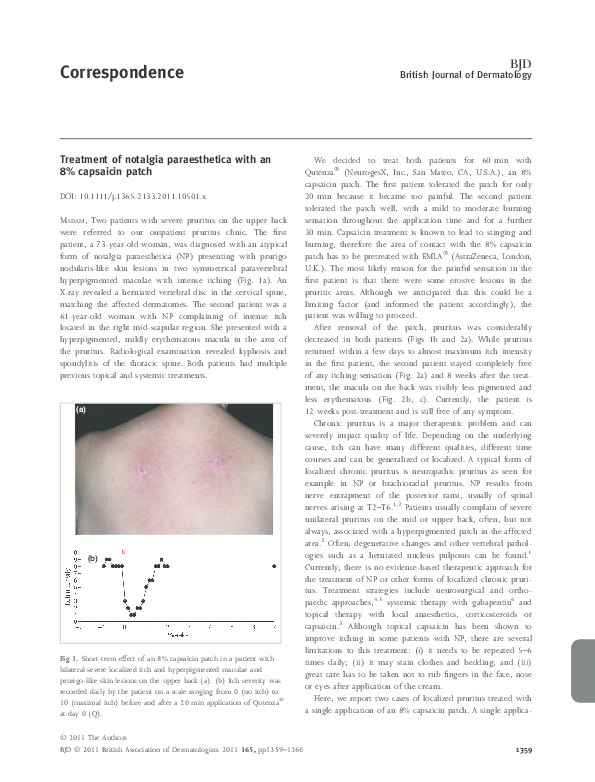 First page of “Treatment of notalgia paraesthetica with an 8% capsaicin patch”