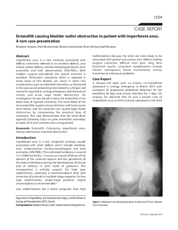 First page of “Enterolith causing bladder outlet obstruction in patient with imperforate anus. A rare case presentation”