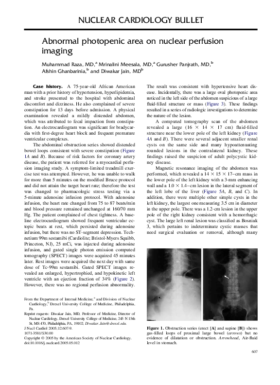 First page of “Abnormal photopenic area on nuclear perfusion imaging”