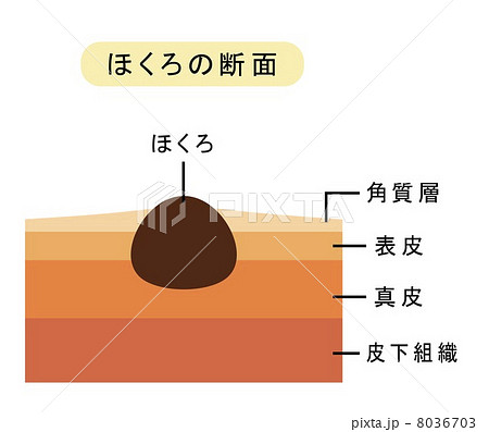 ほくろの断面 8036703