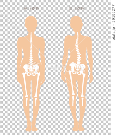 身体の歪み比較 女性 39193277