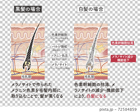 Cross section of the skin 12 front 72584859