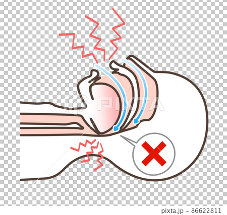 いびきの図解イラスト 86622811