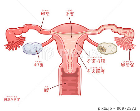 健康な子宮、卵巣、卵管のイラスト（テキスト付き） 80972572
