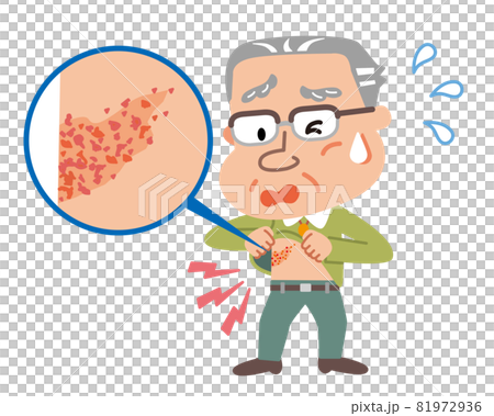 Illustration of an elderly man confirming a rash 81972936