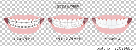 Orthodontic type set illustration 82089699