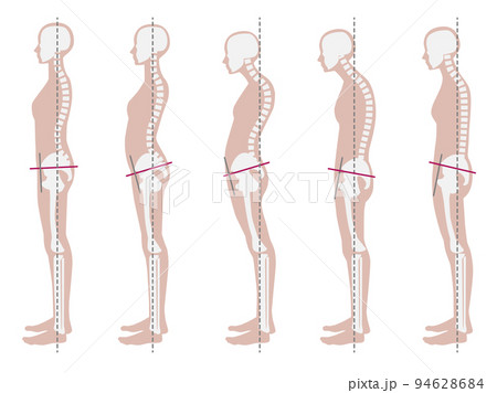 良い姿勢と悪い姿勢の骨格見本 94628684