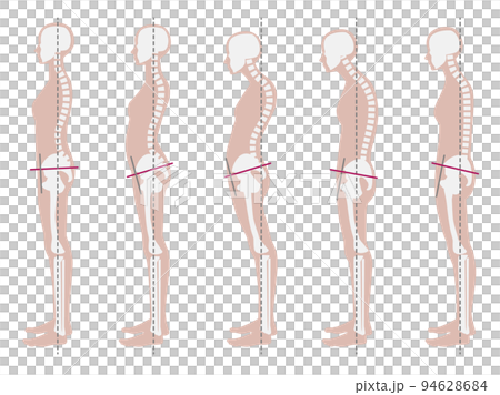 良い姿勢と悪い姿勢の骨格見本 94628684