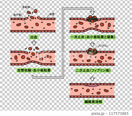 Blood clotting process (with text) 117573865