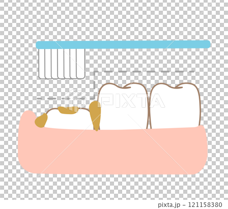 The step of the 6-year-old molars that are difficult to brush and brushing 121158380