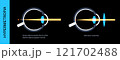 Farsightedness lens correction 121702488