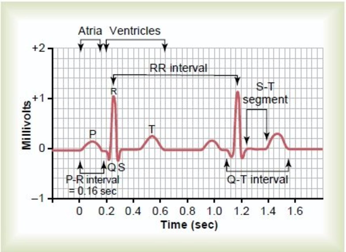 Traçado De Ecg Normal