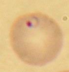 Plasmodium falciparum (Alveolata, Apicomplexa), parasite responsable du paludisme (stade en anneau dans une hématie).