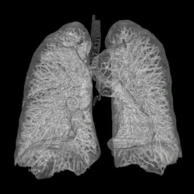 Thorax Lung 3d from ct scans.jpg