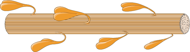 Rheumatology - Myosin 3 -- Smart-Servier.png