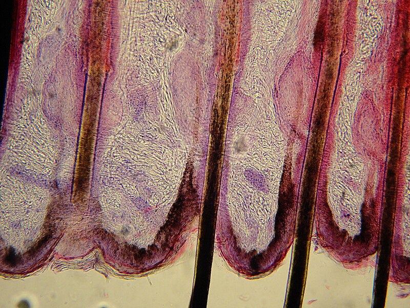 File:Hair follicle of feline - Microscopic view 2.jpg