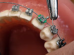 Thumbnail for Orthodontics