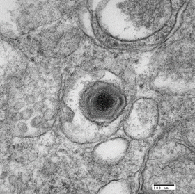 Microfotografia de partícula de vírus