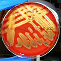 Actinobacillus suis colonies growing on the blood agar.