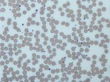 Platelets in human blood