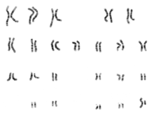 Karyotype of a human male.