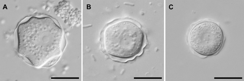 File:Parasite140120-fig4 Acanthamoeba keratitis.png